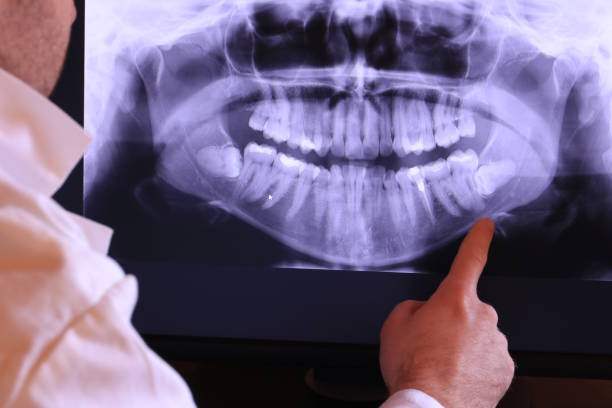 Best Cosmetic Emergency Dentistry in Richmond, KY