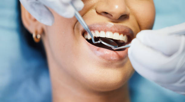 Best Emergency Gum Treatment in Richmond, KY