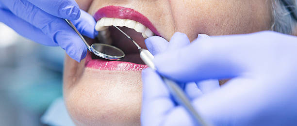 Best Emergency Tooth Extraction in Richmond, KY