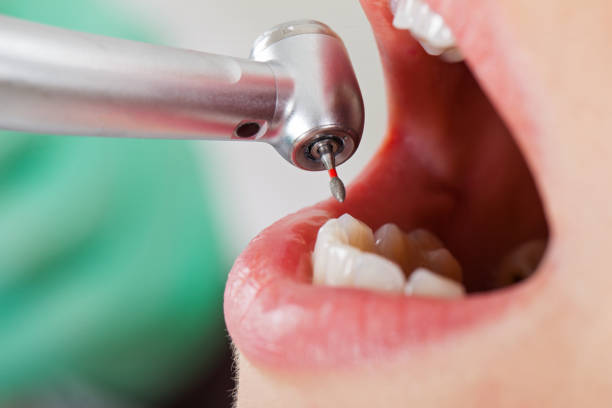 Best Pediatric Emergency Dentist in Richmond, KY